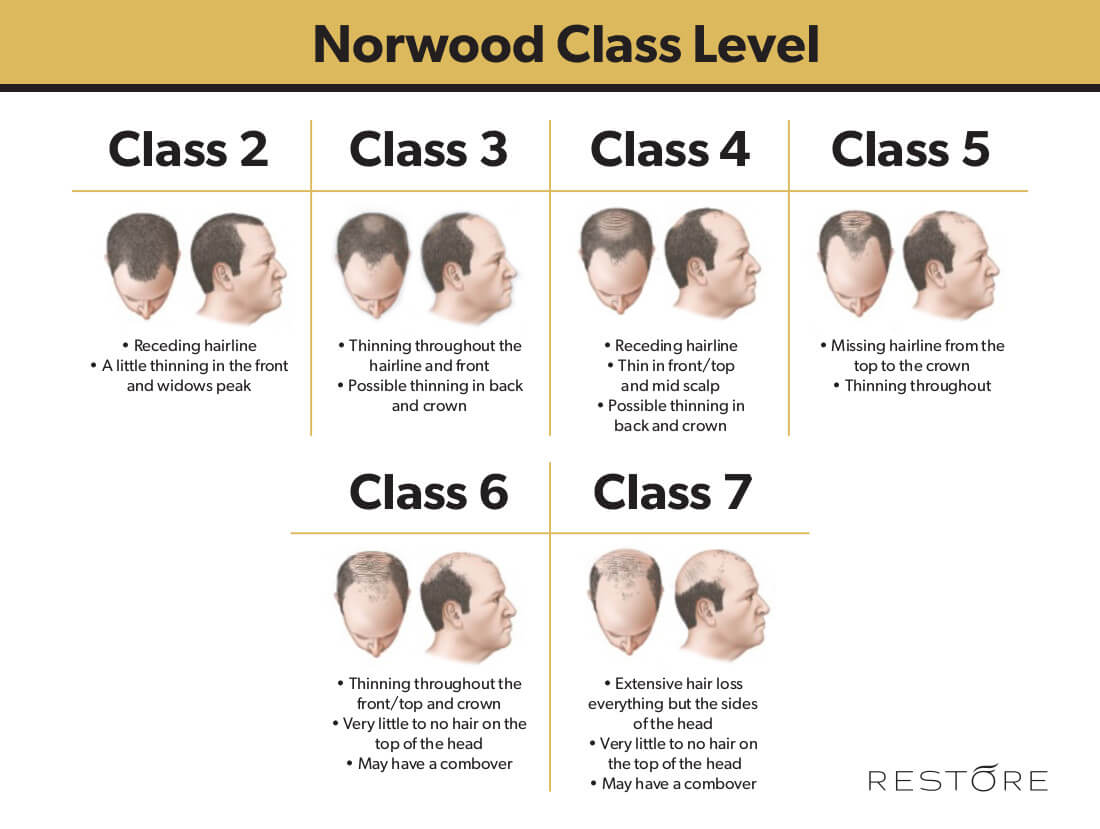 norwood-chart (1)